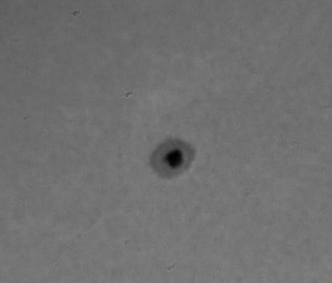 20110104 Sonne Herzfleck